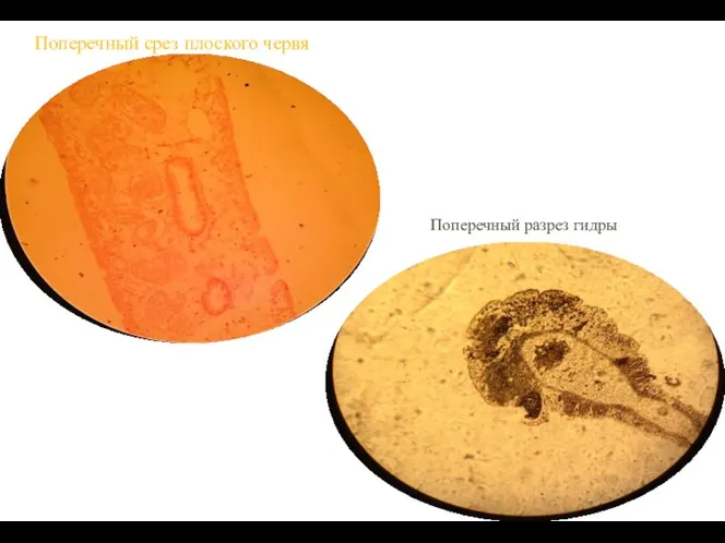 Поперечный срез плоского червя Поперечный разрез гидры