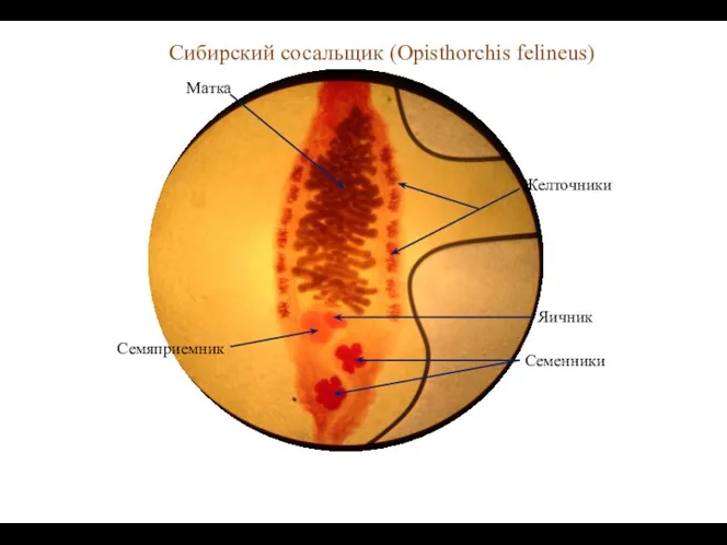 Сибирский сосальщик (Opisthorchis felineus)