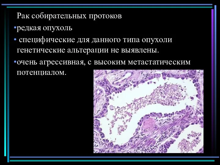 Рак собирательных протоков редкая опухоль специфические для данного типа опухоли генетические альтерации