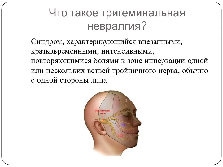 Что такое тригеминальная невралгия? Синдром, характеризующийся внезапными, кратковременными, интенсивными, повторяющимися болями в