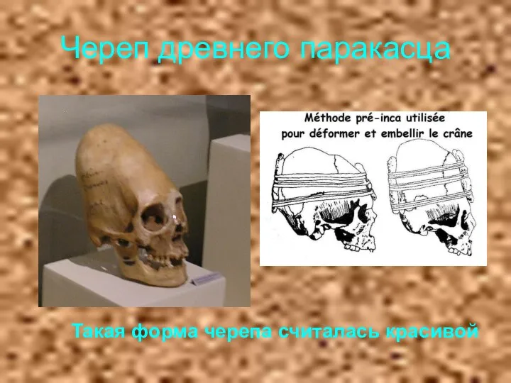 Череп древнего паракасца Такая форма черепа считалась красивой