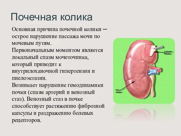 Почечная колика Основная причина почечной колики ─ острое нарушение пассажа мочи по