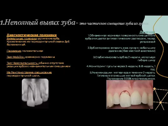 1.Неполный вывих зуба- это частичное смещение зуба из лунки. Диагностические признаки Визуальные