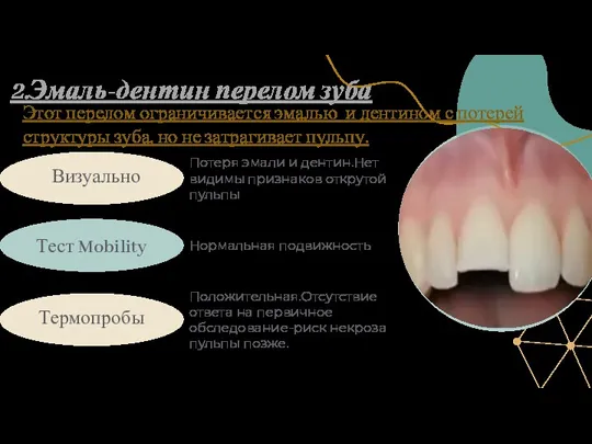 Визуально Тест Mobility Потеря эмали и дентин.Нет видимы признаков открутой пульпы 2.Эмаль-дентин