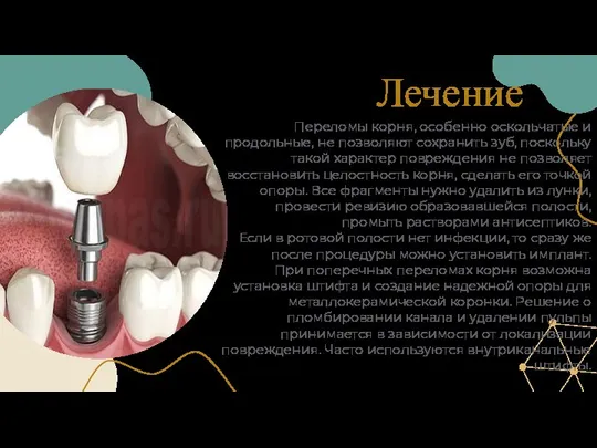 Лечение Переломы корня, особенно оскольчатые и продольные, не позволяют сохранить зуб, поскольку