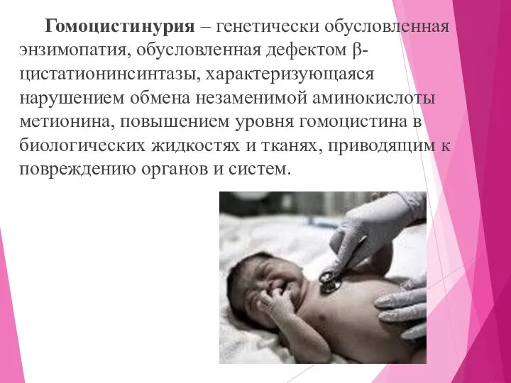 Гомоцистинурия – генетически обусловленная энзимопатия, обусловленная дефектом β-цистатионинсинтазы, характеризующаяся нарушением обмена незаменимой