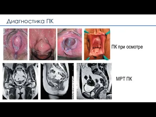 ПК при осмотре МРТ ПК Диагностика ПК