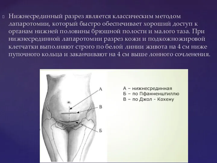 Нижнесрединный разрез является классическим методом лапаротомии, который быстро обеспечивает хороший доступ к