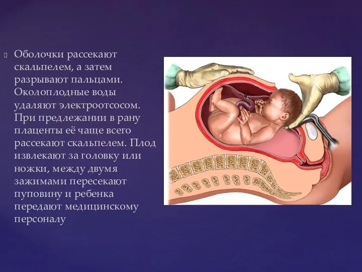 Оболочки рассекают скальпелем, а затем разрывают пальцами. Околоплодные воды удаляют электроотсосом. При