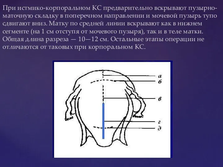 При истмико-корпоральном КС предварительно вскрывают пузырно-маточную складку в поперечном направлении и мочевой