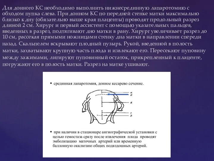 Для донного КС необходимо выполнить нижнесрединную лапаротомию с обходом пупка слева. При