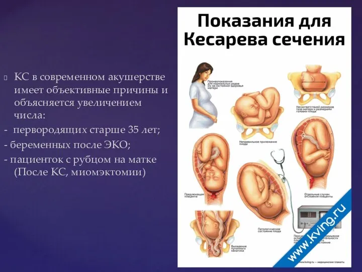 КС в современном акушерстве имеет объективные причины и объясняется увеличением числа: -