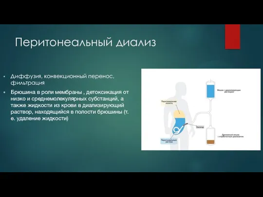 Перитонеальный диализ Диффузия, конвекционный перенос, фильтрация Брюшина в роли мембраны , детоксикация