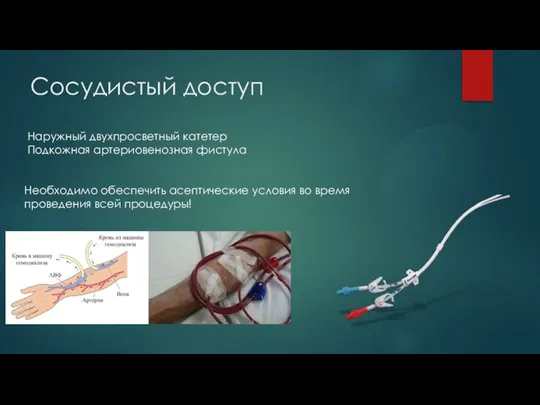 Сосудистый доступ Наружный двухпросветный катетер Подкожная артериовенозная фистула Необходимо обеспечить асептические условия