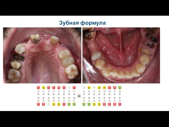 POLNYY PORYADOK Зубная формула