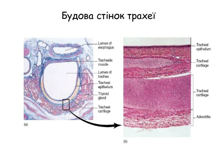 Будова стінок трахеї