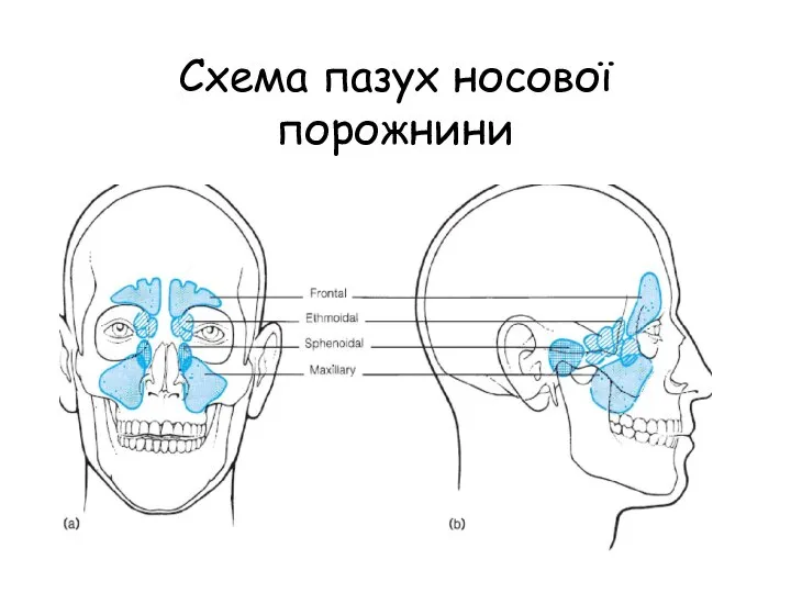Схема пазух носової порожнини