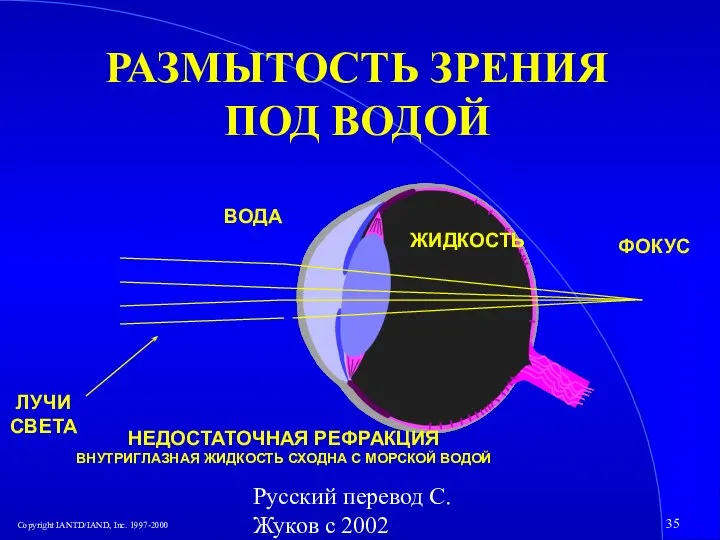 Русский перевод С. Жуков с 2002 РАЗМЫТОСТЬ ЗРЕНИЯ ПОД ВОДОЙ