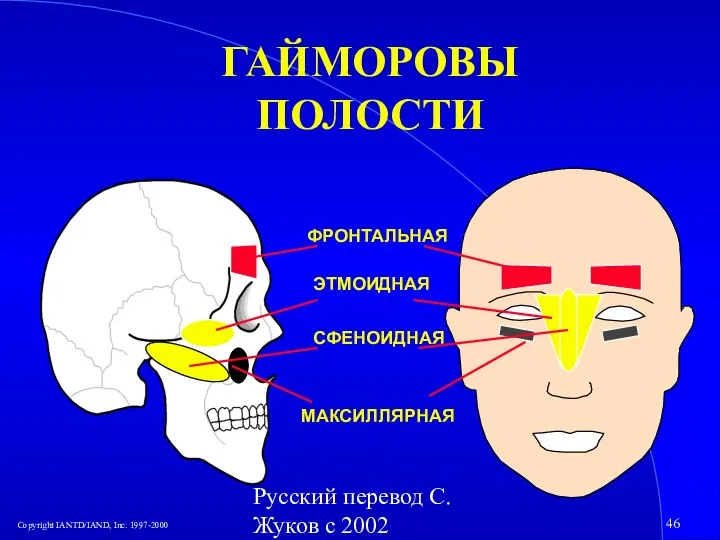 Русский перевод С. Жуков с 2002 ГАЙМОРОВЫ ПОЛОСТИ ФРОНТАЛЬНАЯ ЭТМОИДНАЯ СФЕНОИДНАЯ МАКСИЛЛЯРНАЯ