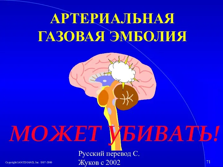 Русский перевод С. Жуков с 2002 АРТЕРИАЛЬНАЯ ГАЗОВАЯ ЭМБОЛИЯ МОЖЕТ УБИВАТЬ!