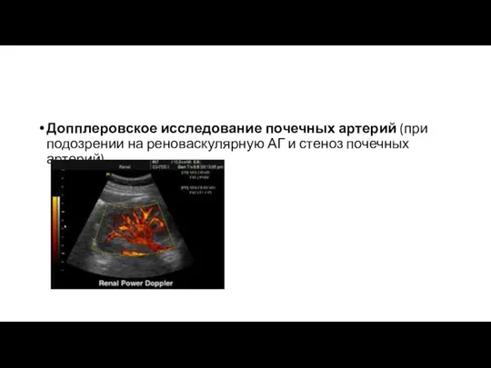 Допплеровское исследование почечных артерий (при подозрении на реноваскулярную АГ и стеноз почечных артерий)