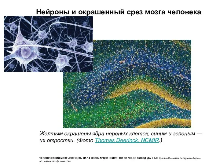 Нейроны и окрашенный срез мозга человека Желтым окрашены ядра нервных клеток, синим