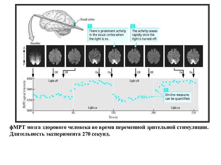 фМРТ мозга здорового человека во время переменной зрительной стимуляции. Длительность эксперимента 270 секунд.
