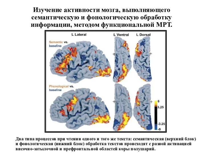 Изучение активности мозга, выполняющего семантическую и фонологическую обработку информации, методом функциональной МРТ.