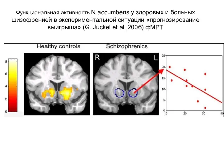 Функциональная активность N.аccumbens у здоровых и больных шизофренией в экспериментальной ситуации «прогнозирование