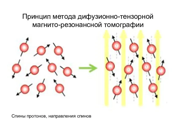 Спины протонов, направления спинов Принцип метода дифузионно-тензорной магнито-резонансной томографии