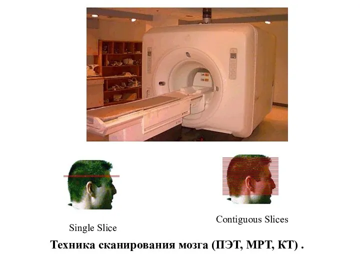 Single Slice Contiguous Slices Техника сканирования мозга (ПЭТ, МРТ, КТ) .