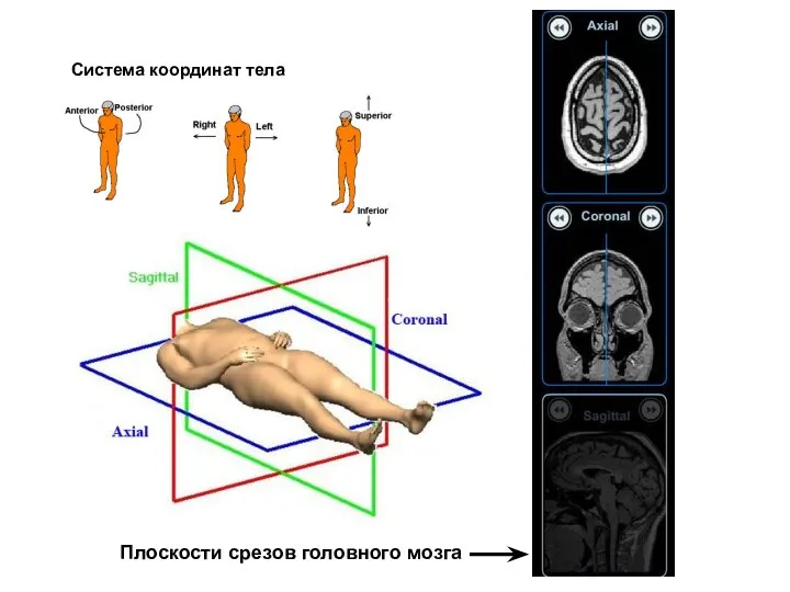 Система координат тела Плоскости срезов головного мозга