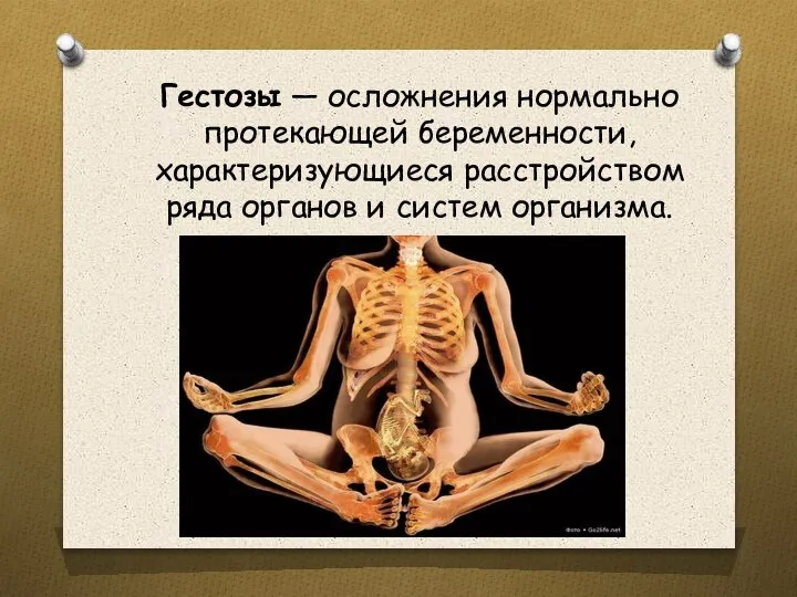 Гестозы — осложнения нормально протекающей беременности, характеризующиеся расстройством ряда органов и систем организма.