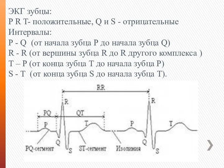 ЭКГ зубцы: Р R T- положительные, Q и S - отрицательные Интервалы: