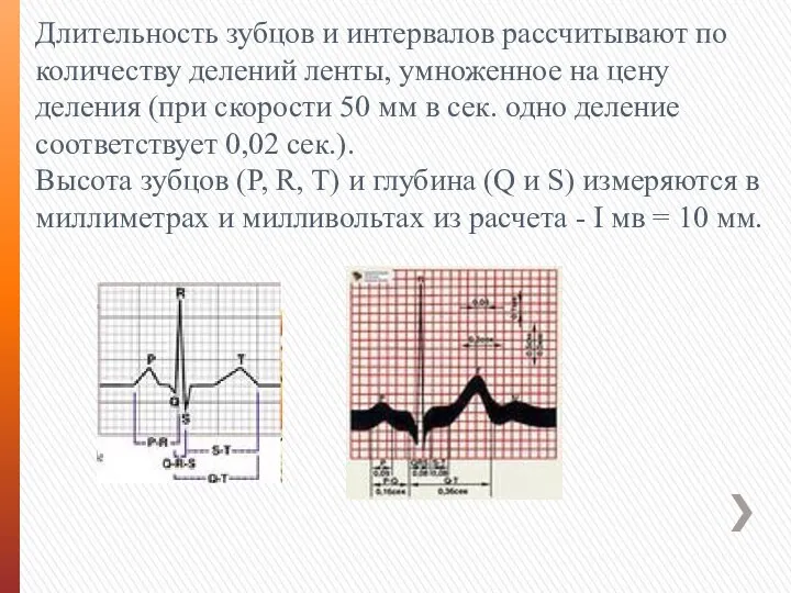 Длительность зубцов и интервалов рассчитывают по количеству делений ленты, умноженное на цену