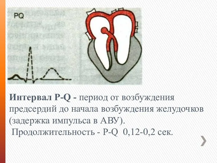 Интервал Р-Q - период от возбуждения предсердий до начала возбуждения желудочков (задержка