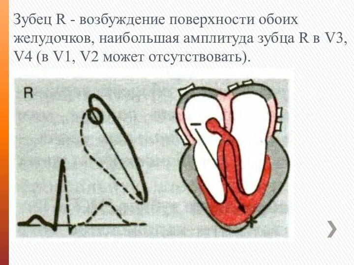 Зубец R - возбуждение поверхности обоих желудочков, наибольшая амплитуда зубца R в