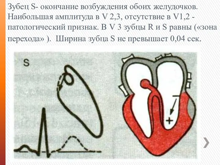 Зубец S- окончание возбуждения обоих желудочков. Наибольшая амплитуда в V 2,3, отсутствие