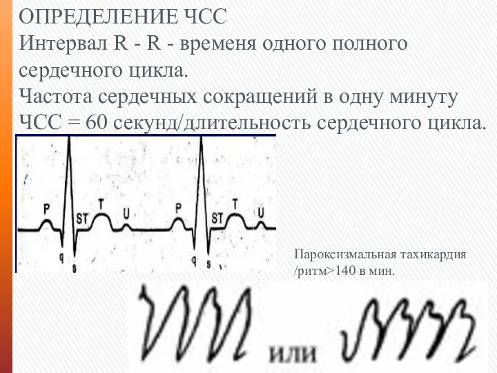 ОПРЕДЕЛЕНИЕ ЧСС Интервал R - R - временя одного полного сердечного цикла.