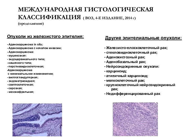 МЕЖДУНАРОДНАЯ ГИСТОЛОГИЧЕСКАЯ КЛАССИФИКАЦИЯ ( ВОЗ, 4-Е ИЗДАНИЕ, 2014 г) (продолжение) Опухоли из