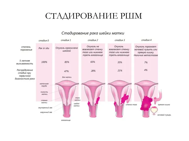 СТАДИРОВАНИЕ РШМ