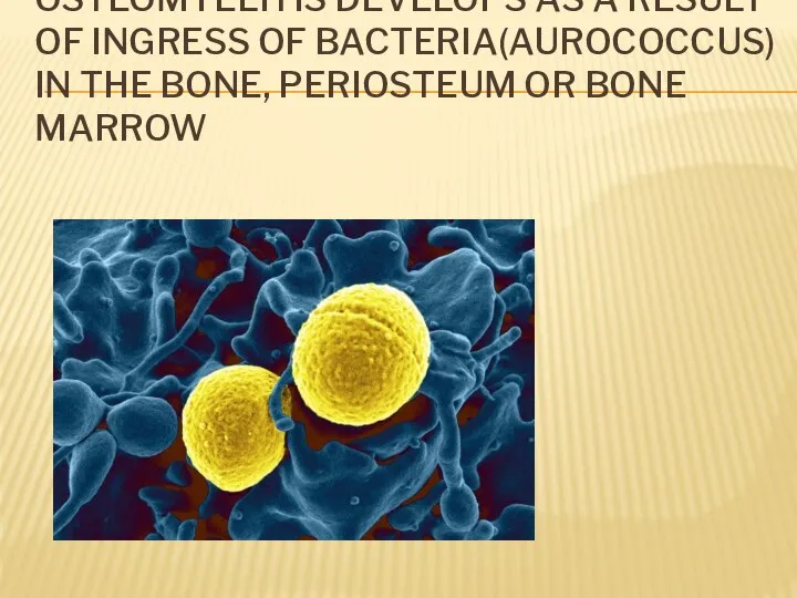 OSTEOMYELITIS DEVELOPS AS A RESULT OF INGRESS OF BACTERIA(AUROCOCCUS) IN THE BONE, PERIOSTEUM OR BONE MARROW