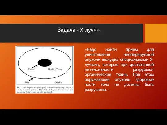 Задача «Х лучи» «Надо найти прием для уничтожения неоперируемой опухоли желудка специальными