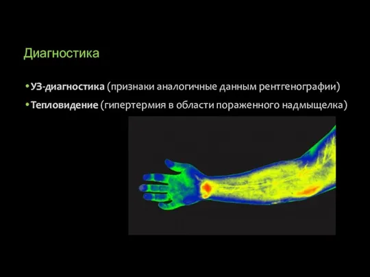 Диагностика УЗ-диагностика (признаки аналогичные данным рентгенографии) Тепловидение (гипертермия в области пораженного надмыщелка)