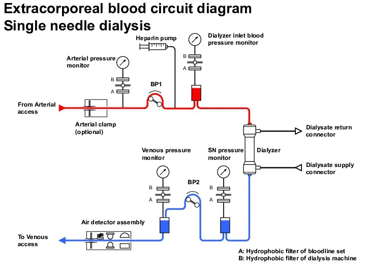 Extracorporeal blood circuit diagram Single needle dialysis A B A B A