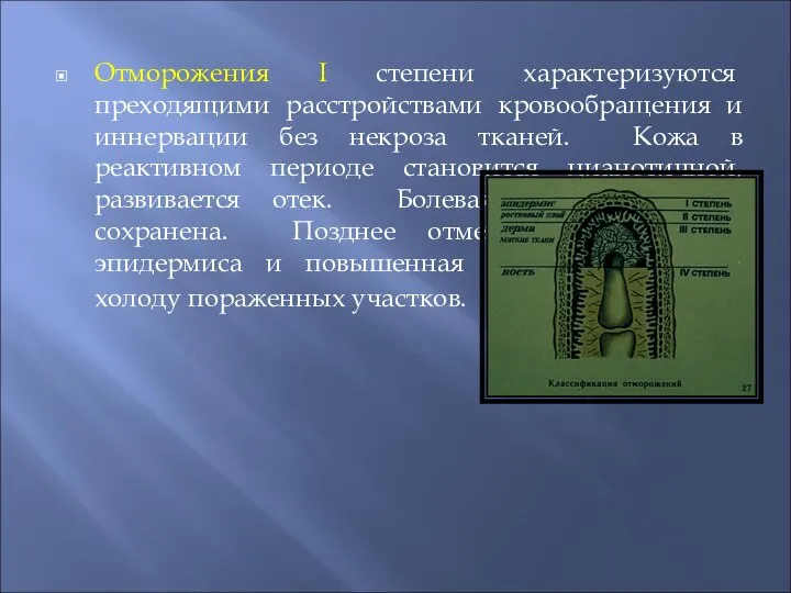 Отморожения I степени характеризуются преходящими расстройствами кровообращения и иннервации без некроза тканей.