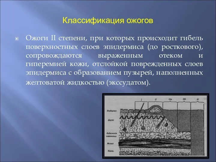 Классификация ожогов Ожоги II степени, при которых происходит гибель поверхностных слоев эпидермиса