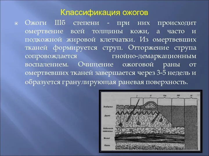 Классификация ожогов Ожоги IIIб степени - при них происходит омертвение всей толщины