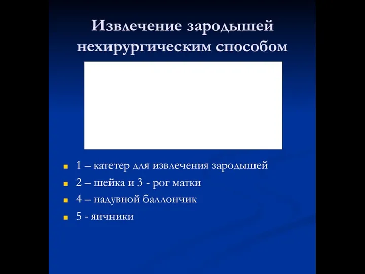 Извлечение зародышей нехирургическим способом 1 – катетер для извлечения зародышей 2 –