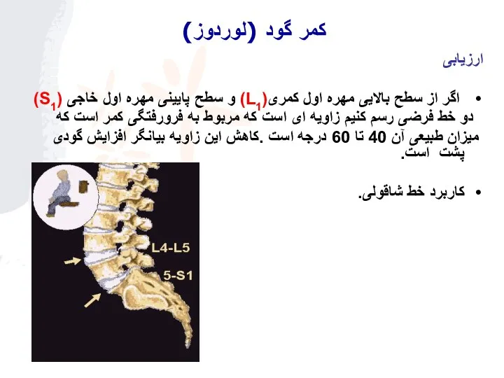 ارزیابی اگر از سطح بالایی مهره اول کمری(L1) و سطح پایینی مهره